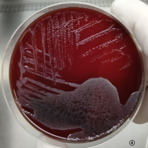 当检验君遇到“布鲁君”狭路相逢勇者胜——马尔他布鲁菌血流感染一例 ... ...